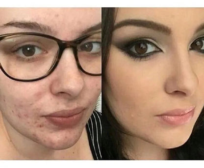 Swatch of foundation applied to skin, demonstrating coverage and blendability